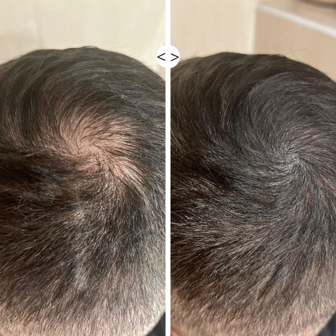 Routine cheveux clairsemés : Fond de Cheveux + Applicateur Kabuki
