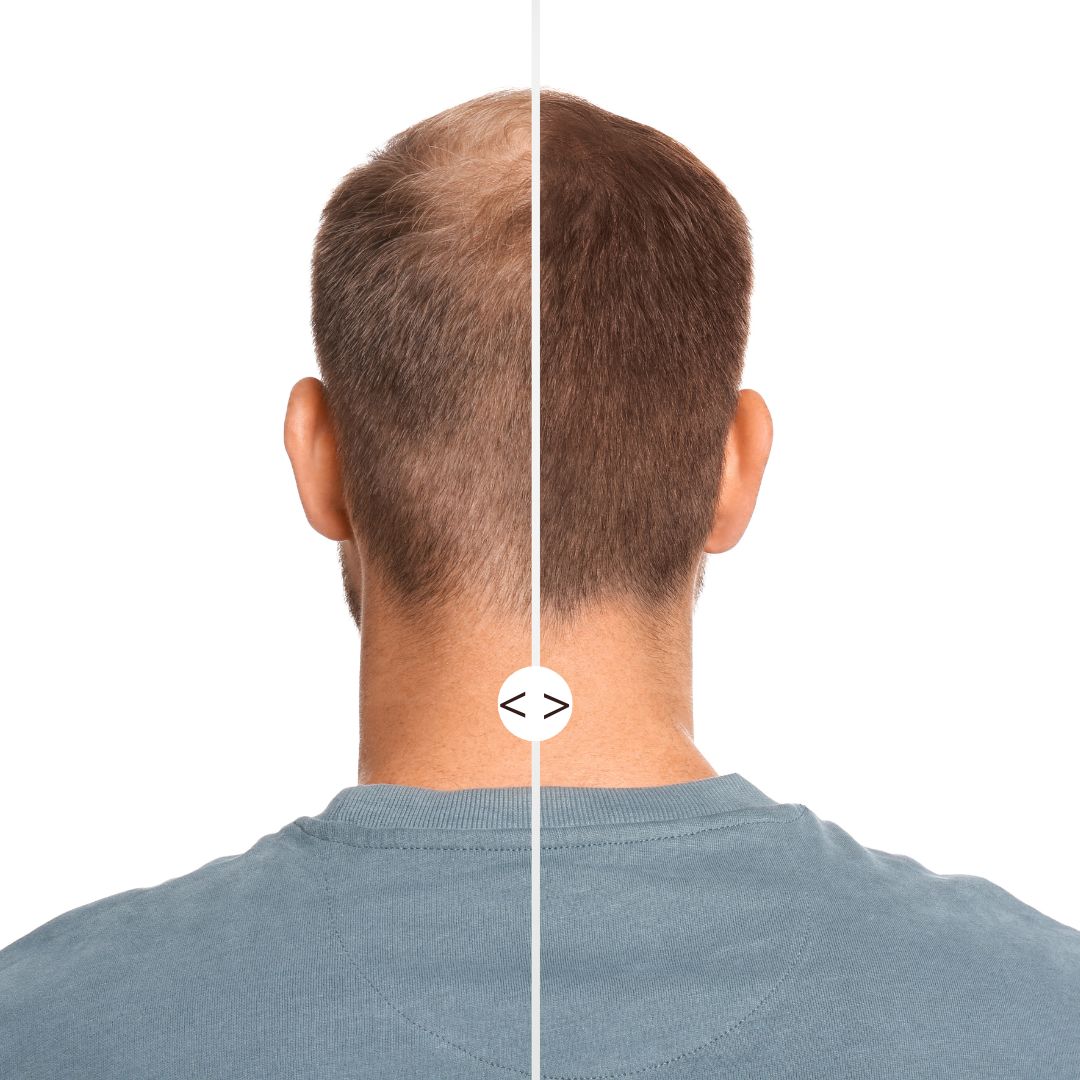 Routine cheveux clairsemés : Fond de Cheveux + Applicateur Kabuki